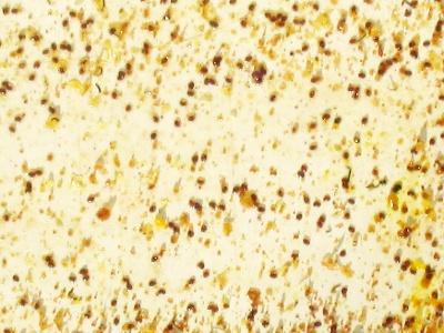 Blindentext Varroamilben